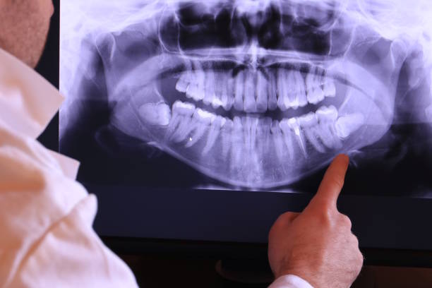 Best Emergency Dentist for Special Needs Patients in Chalfant, CA